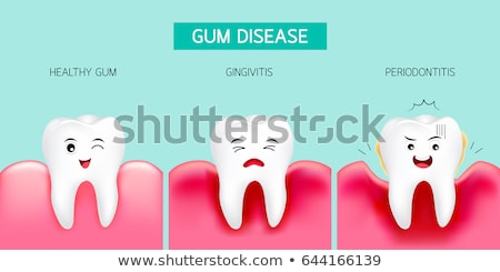 Сток-фото: Gum Disease - Medical Concept