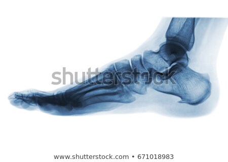 Stockfoto: Ankle X Ray