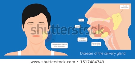 Stockfoto: Examining Infection In The Mouth