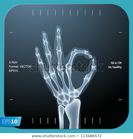 ストックフォト: X Ray Of The Right Hand