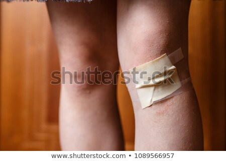 Stok fotoğraf: Scraped Knee