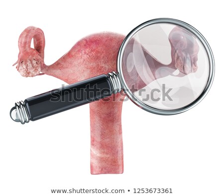 Stockfoto: Vaginitis Diagnosis Medical Concept 3d