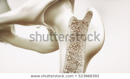 Foto d'archivio: Normal Bone And Bone With Osteoporosis