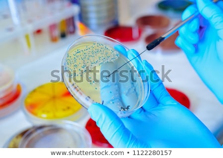 Foto stock: Scientist Analyzing Petri Dish Bacterial Cultures In Laboratory