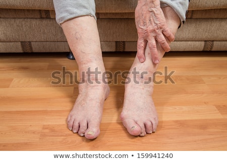 Stock photo: Woman Holding Painful Toenail