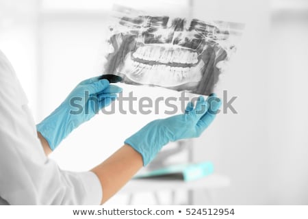 Foto d'archivio: Doctor Looking Dental X Ray