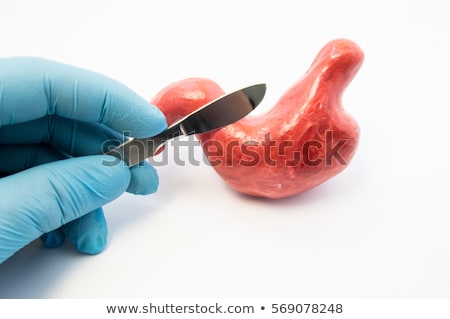 Stockfoto: Gastric Bypass And Gastric Band