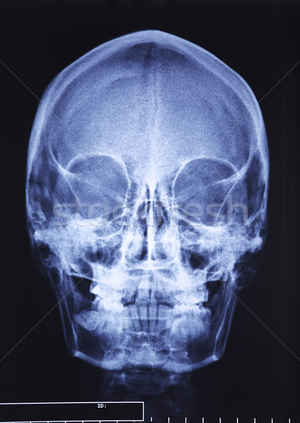 skull xray Stock photo © tiero