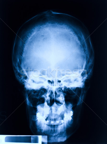 skull x-ray Stock photo © tiero