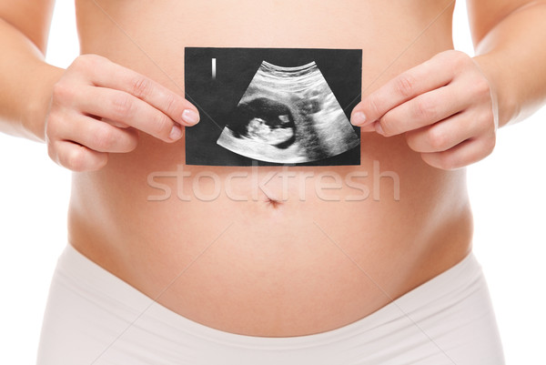Stock fotó: Terhes · nő · tart · scan · baba · nő · szeretet