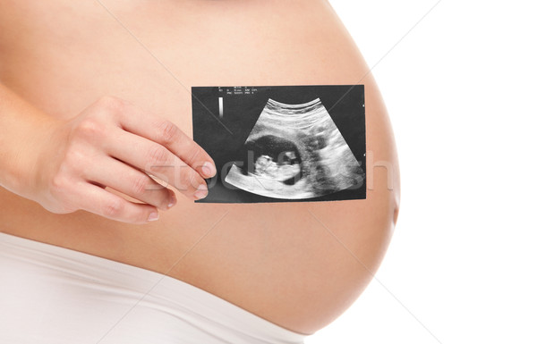 Femme enceinte scanner bébé femme amour [[stock_photo]] © tommyandone