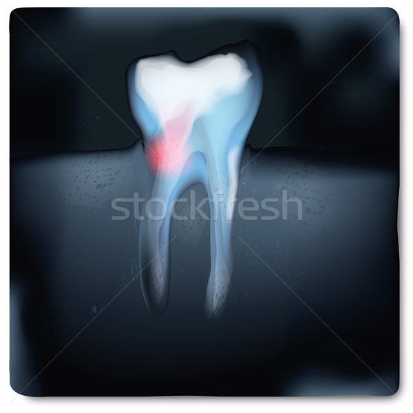 X-ray image with tooth and tooth pain  Stock photo © Ustofre9