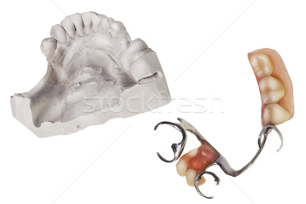 Plaster cast of  teeth and dentures Stock photo © vavlt