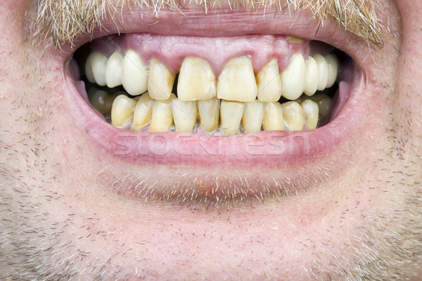 Citromsárga fogak stúdiófelvétel bőr bajusz makró Stock fotó © vavlt