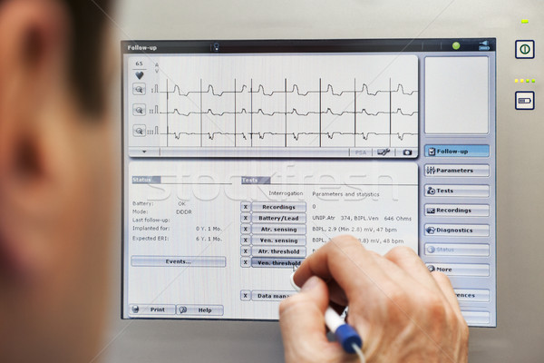 врач сердце кардиостимулятор контроля здоровья больницу Сток-фото © vilevi