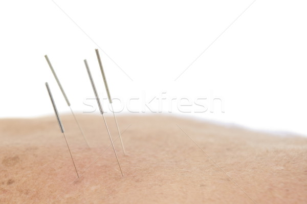Akupunktur iğneler uygulama güzellik tıp geri Stok fotoğraf © vtupinamba