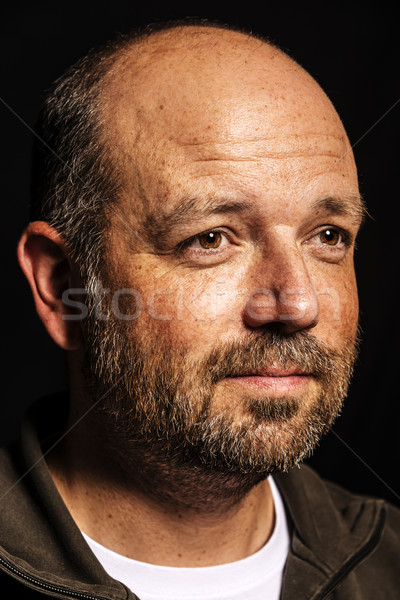 Baldness man Stock photo © w20er