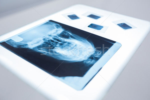 Stock photo: Close up of a x-ray of a human skull on the table 