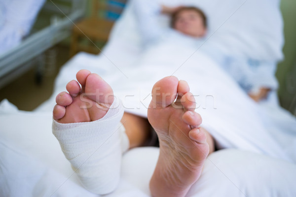 Patient with broken leg in a plaster cast Stock photo © wavebreak_media