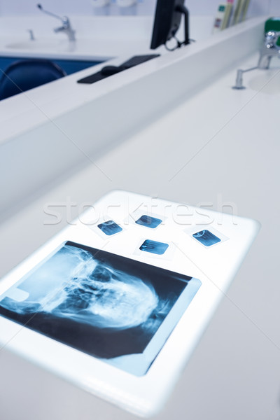 Xray menselijke schedel tabel tandheelkundige kliniek Stockfoto © wavebreak_media