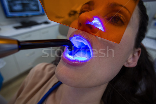 Dentists examining female patient with dental curing light Stock photo © wavebreak_media