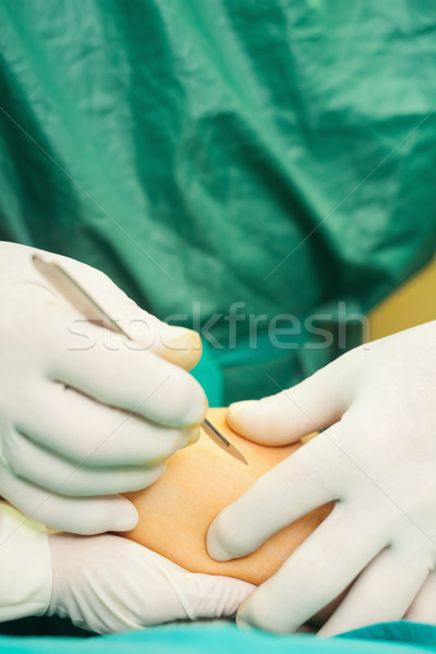 Close up of a surgeon holding a scalpel in a surgical room Stock photo © wavebreak_media