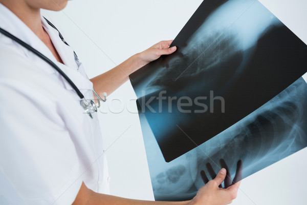 Mid section of female doctor examining X-rays Stock photo © wavebreak_media