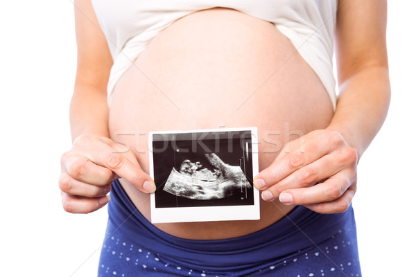 Hamile kadın ultrason sağlık kadın gebelik Stok fotoğraf © wavebreak_media