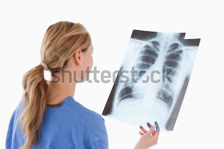 Női orvos néz röntgen fehér lány Stock fotó © wavebreak_media