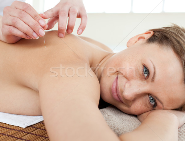 Portrait of a cheerful woman in acupuncture therapy Stock photo © wavebreak_media