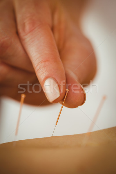 Acupunctura tratament terapie cameră femeie Imagine de stoc © wavebreak_media