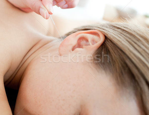 Acupuncture needles on a young woman's ear Stock photo © wavebreak_media