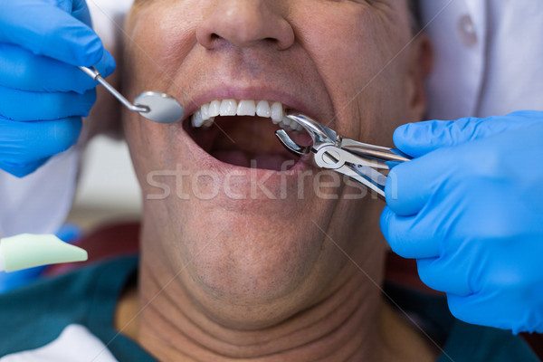 Dentist using surgical pliers to remove a decaying tooth Stock photo © wavebreak_media