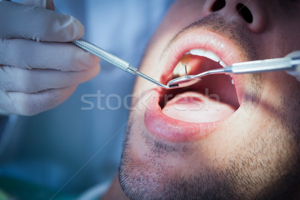 Close up of man having his teeth examined Stock photo © wavebreak_media