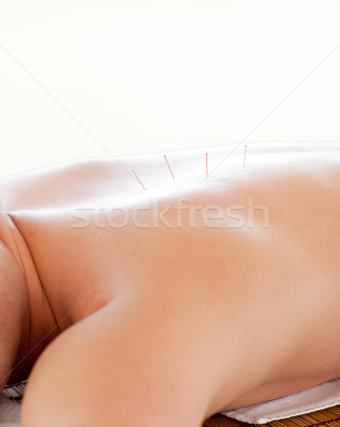 Primer plano caucásico hombre acupuntura terapia spa Foto stock © wavebreak_media
