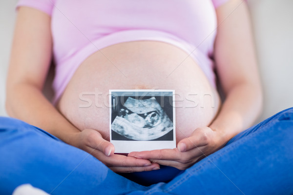Terhes nő mutat ultrahang otthon nappali egészség Stock fotó © wavebreak_media