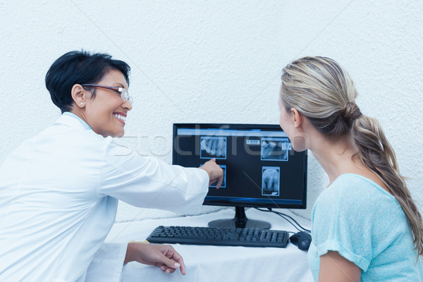 牙科醫生 顯示 女子 口 X射線 計算機 商業照片 © wavebreak_media