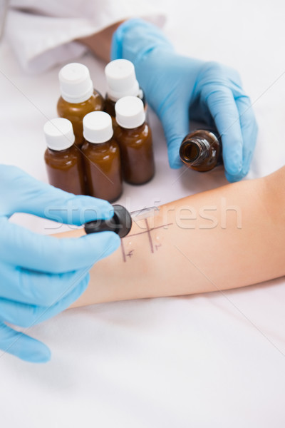 Doctor doing skin prick test at his patient  Stock photo © wavebreak_media