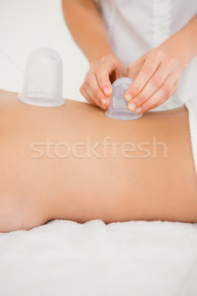 Woman with vacuum cups on her back Stock photo © wavebreak_media