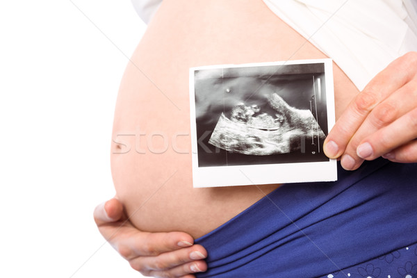 Pregnant woman showing ultrasound scans Stock photo © wavebreak_media