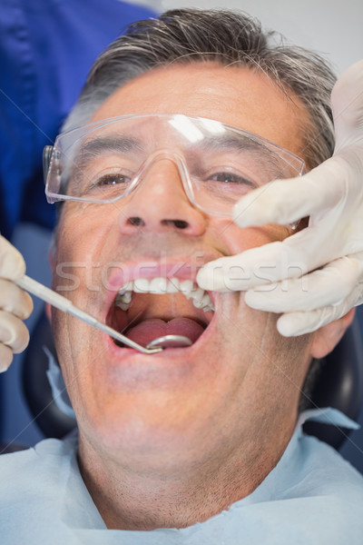 病人 牙科醫生 檢查 鏡子 牙科 商業照片 © wavebreak_media