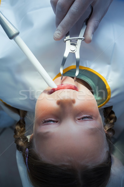 Close up of girl having her teeth examined Stock photo © wavebreak_media