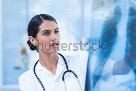 [[stock_photo]]: Belle · médecin · xray · hôpital · chambre · femme