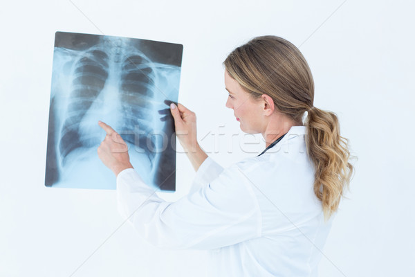 [[stock_photo]]: Médecin · regarder · xray · blanche · signe