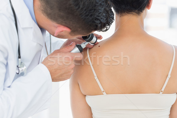 Dermatolog mol înapoi femeie masculin Imagine de stoc © wavebreak_media
