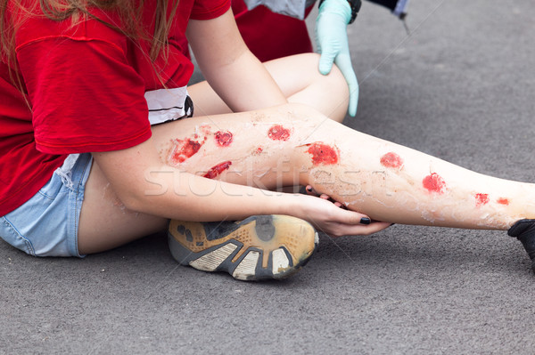 Lesiones deportivas piel simulación pierna lesión primeros auxilios Foto stock © wellphoto