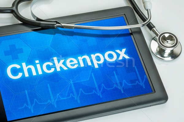 Stock photo: Tablet with the diagnosis Chickenpox on the display