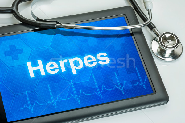 Stock photo: Tablet with the diagnosis Herpes on the display