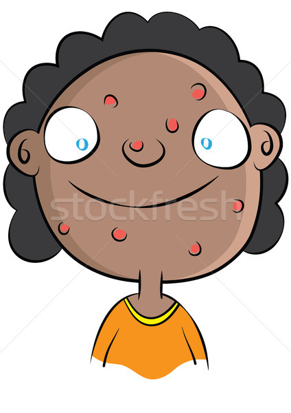 Cute schwarz Mädchen Akne Problem Stock foto © zkruger
