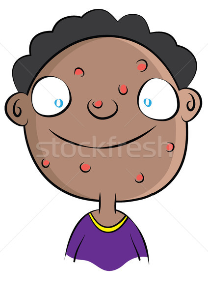 Cute schwarz Junge Akne Problem Stock foto © zkruger
